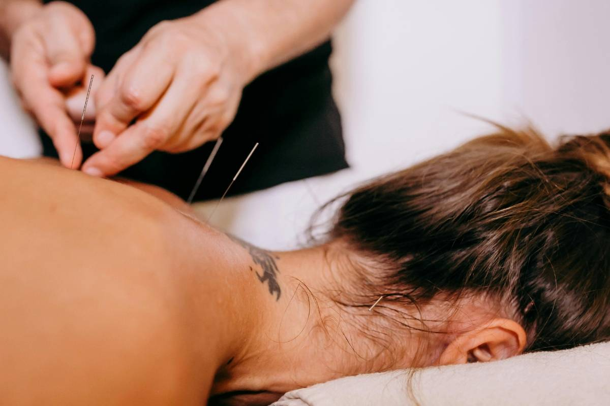 Dry Needling In Efland